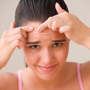 5 tips para cuidar la piel con acné